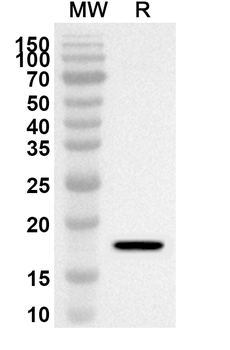 WT1 Rabbit Polyclonal Antibody