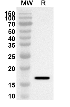 STMN1 Rabbit Polyclonal Antibody