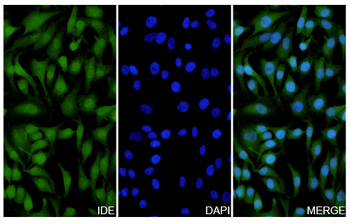 IDE Rabbit Polyclonal Antibody