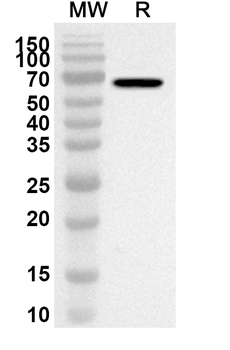 PKM Rabbit Polyclonal Antibody