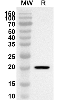 BCR Rabbit Polyclonal Antibody