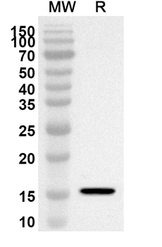 MAPT Rabbit Polyclonal Antibody