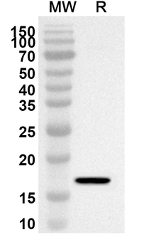 CD7 Rabbit Polyclonal Antibody