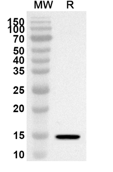 CD10/MME Rabbit Polyclonal Antibody