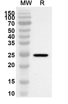 CD220/INSR Rabbit Polyclonal Antibody