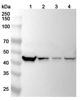 KRT18 Rabbit Polyclonal Antibody