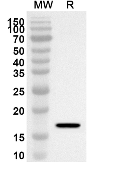 CD74 Rabbit Polyclonal Antibody