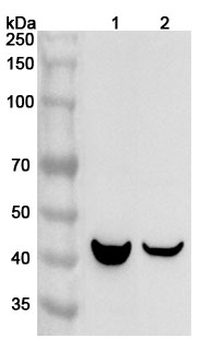 ORM1/a1AGP Rabbit Polyclonal Antibody
