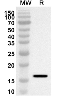 CALCA/Calcitonin Rabbit Polyclonal Antibody