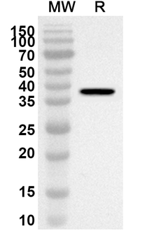 OAS1 Rabbit Polyclonal Antibody