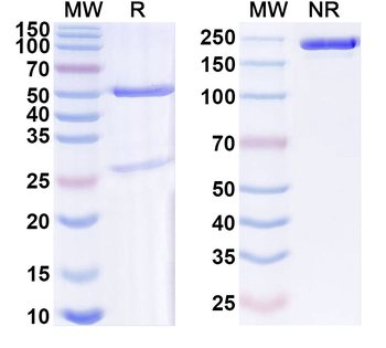 CRP Monoclonal Mouse Monoclonal Antibody