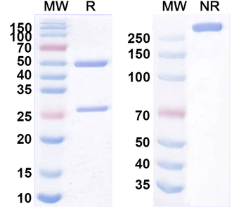 AFP/Alpha-fetoprotein Monoclonal Mouse Monoclonal Antibody