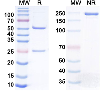 IGFBP1 Monoclonal Mouse Monoclonal Antibody