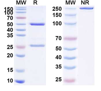 B2M/β2-MG Mouse Monoclonal Antibody