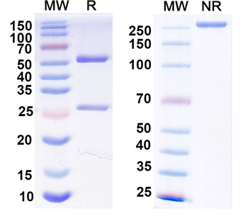 B2M/β2-MG Mouse Monoclonal Antibody