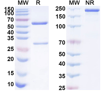 B2M/β2-MG Mouse Monoclonal Antibody