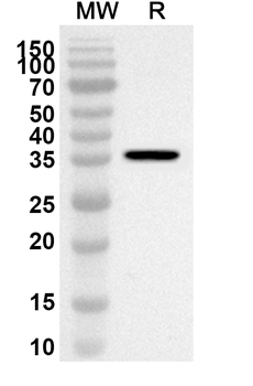 ATP1A1 Rabbit Polyclonal Antibody