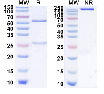 PRDM10 IP Mouse Monoclonal Antibody
