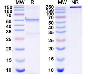 TSC2 IP Mouse Monoclonal Antibody