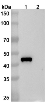 Gal d 2 IgE Human Monoclonal Antibody