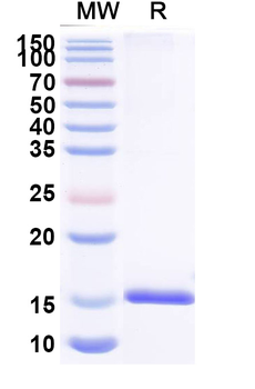 Helicobacter pylori ureC/glmM Camelus Monoclonal Antibody