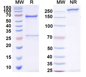 Brucella A antigen Human Monoclonal Antibody