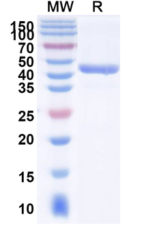 TREM2 Human Monoclonal Antibody