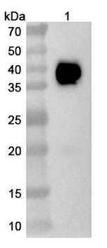 MSLN/Mesothelin Camelus Monoclonal Antibody