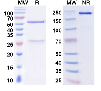 Norovirus/Norwalk virus Capsid protein VP1/p59 Human Monoclonal Antibody