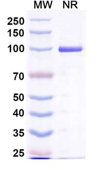 Norovirus/Norwalk virus Capsid protein/VP1 Human Monoclonal Antibody