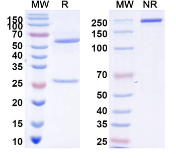 Nipah virus/NiV Fusion glycoprotein F1 Human Monoclonal Antibody