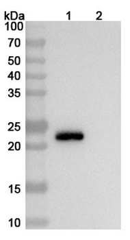 O157:H7 shiga toxin type 1 B/stx1B Mouse Monoclonal Antibody