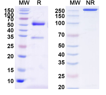 Clostridium botulinum HA-33/Hemagglutinin 33 Mouse Monoclonal Antibody