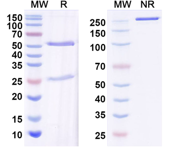 CDY1 Mouse Monoclonal Antibody