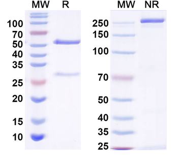 MMACHC Mouse Monoclonal Antibody