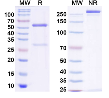 GIT1 Mouse Monoclonal Antibody