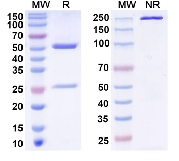 GIT1 Mouse Monoclonal Antibody