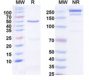 CLN6 Mouse Monoclonal Antibody