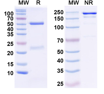 SynDIG1/Tmem90b Mouse Monoclonal Antibody