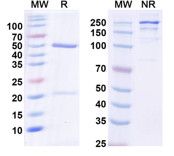 TrpM7 Mouse Monoclonal Antibody