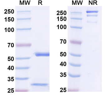 Beta1-spectrin Mouse Monoclonal Antibody
