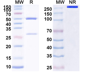 LRRK2/Dardarin Mouse Monoclonal Antibody