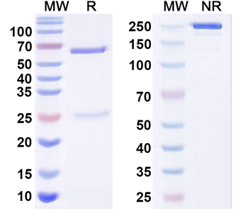 Kvbeta1.2 K+ channel Mouse Monoclonal Antibody