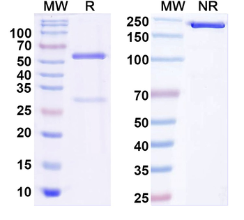 Kir6.2 K+ channel Mouse Monoclonal Antibody