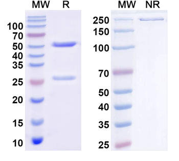 GIT2 Mouse Monoclonal Antibody
