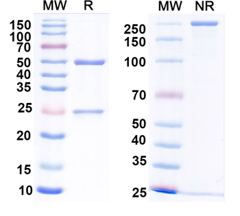 Calretinin Mouse Monoclonal Antibody