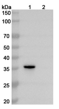VDAC1 Mouse Monoclonal Antibody