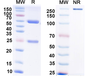 TREK-1 K+ channel Mouse Monoclonal Antibody