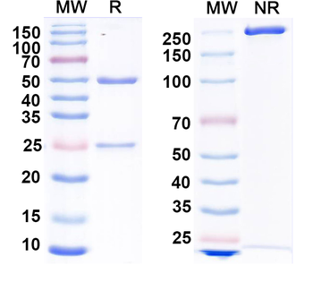INPP4b Mouse Monoclonal Antibody
