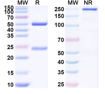SAPAP1 Mouse Monoclonal Antibody